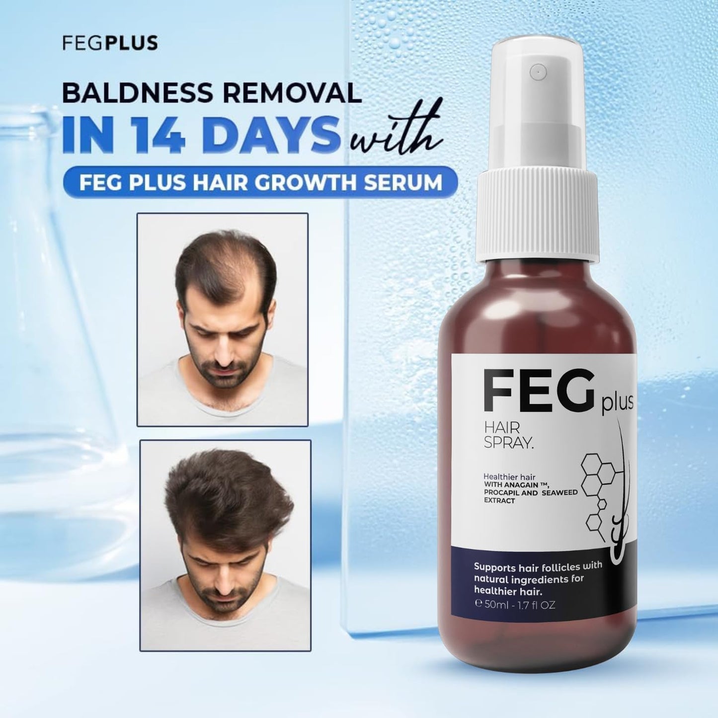 رذاذ نمو الشعر FEG Plus - نمو سريع وطبيعي 🌿💇♀️