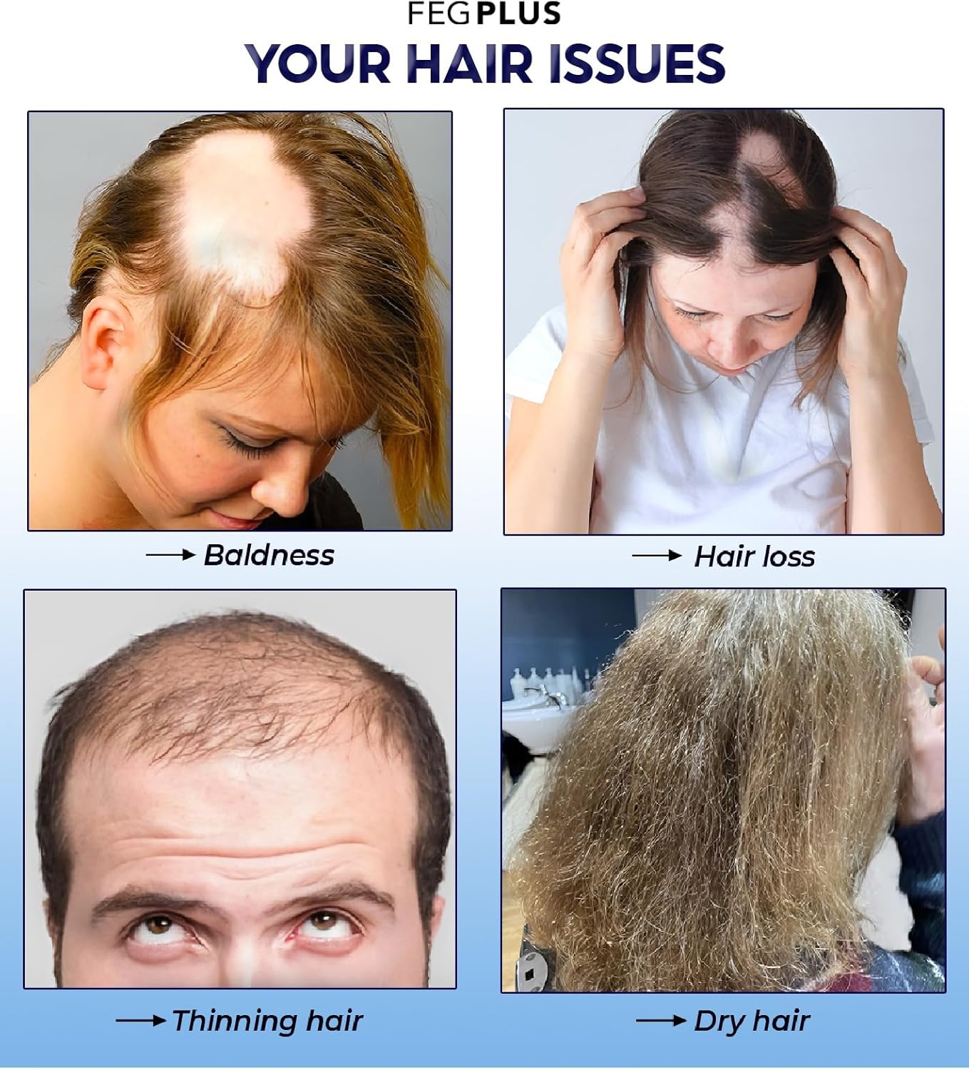 رذاذ نمو الشعر FEG Plus - نمو سريع وطبيعي 🌿💇‍♀️