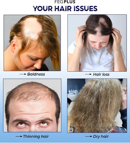 رذاذ نمو الشعر FEG Plus - نمو سريع وطبيعي 🌿💇‍♀️